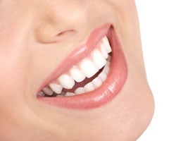 dental implants Cleveland