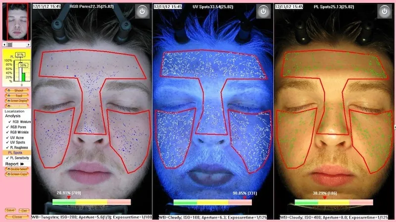 EMAGE 3-D Skin Analysis example, to better treat surface and subsurface conditions