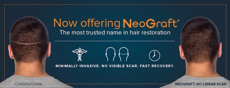 Now offering NeoGraft® the most trusted name in hair restoration