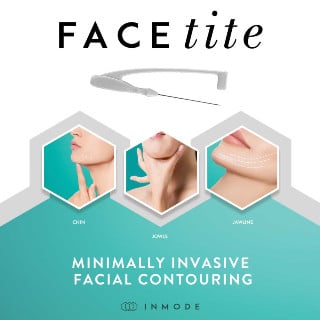 FaceTite Minimally Invasive Facial Contouring