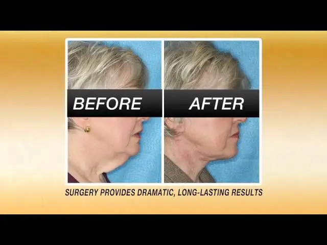 Visage Anti Aging Segment 60