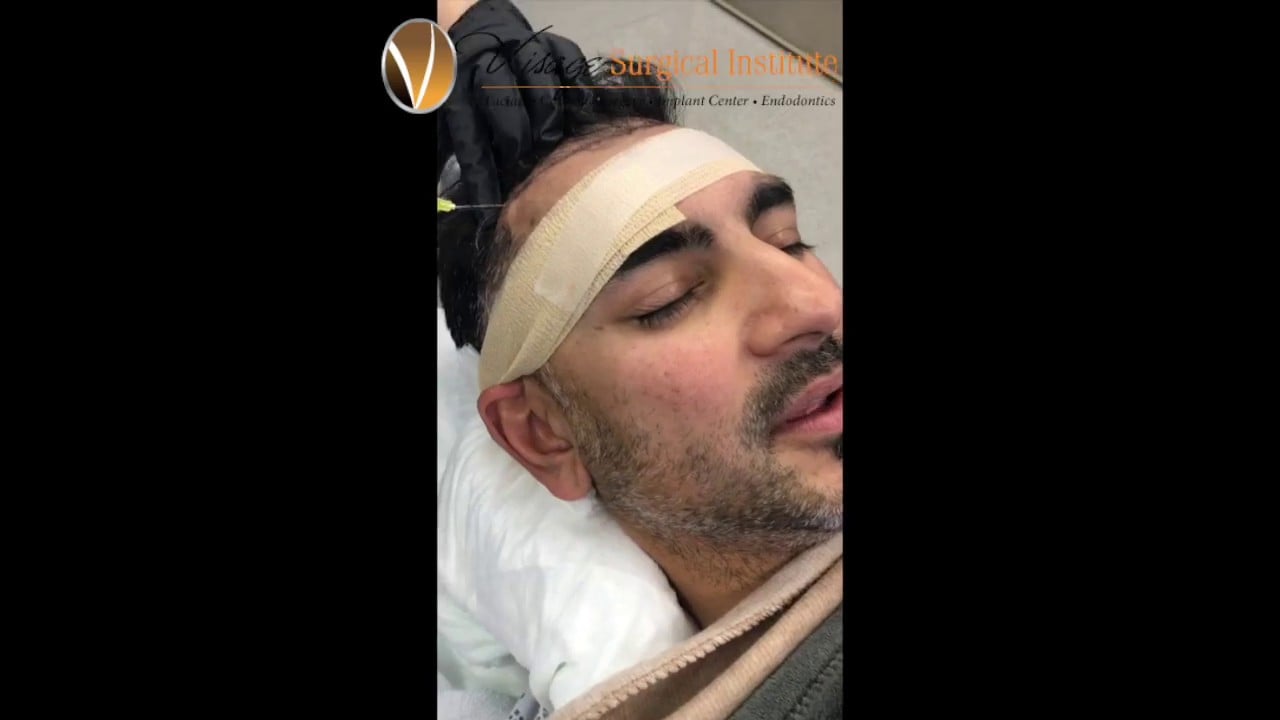 Neograft Visage 1 20 17 Video Thumbnail